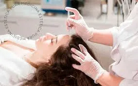 Innovaciones en Medicina Estética: Microneedling Médico y Exosomas